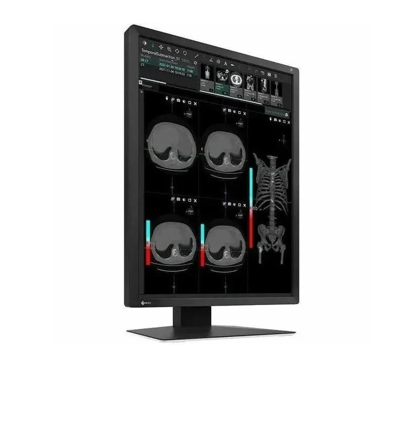 21.3" Eizo Radiforce MX217 1600x1200 LED Monitor MX217-BK