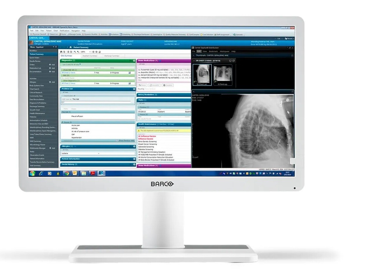 Barco Eonis 22" MDRC-2222 Full HD 2MP Color Clinical LCD Monitor Display *NEW*