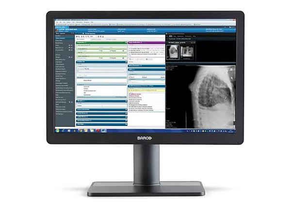 Barco Eonis MDRC-2324 SNIB 2MP 24" Clinical Review Monitor - K9350055