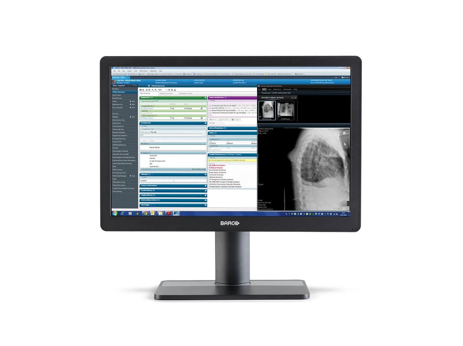 Barco NV Eonis 24" MDRC-2424 SNIB Clinical LCD Monitor