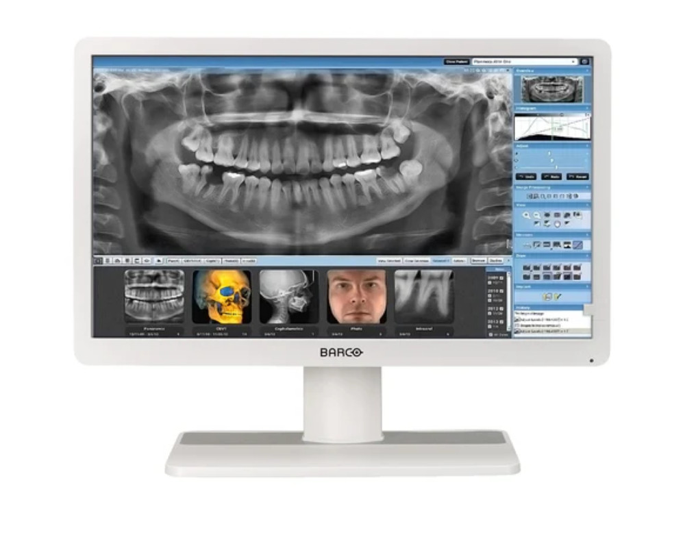 Barco Eonis MDRC-2324 HNEW 2MP 24" Clinical Review Monitor - K9350081
