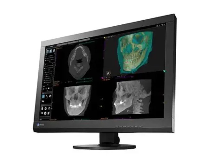 EIZO RadiForce MX242W 24.1" IPS TFT LCD Widescreen Monitor with DICOM 14 Support