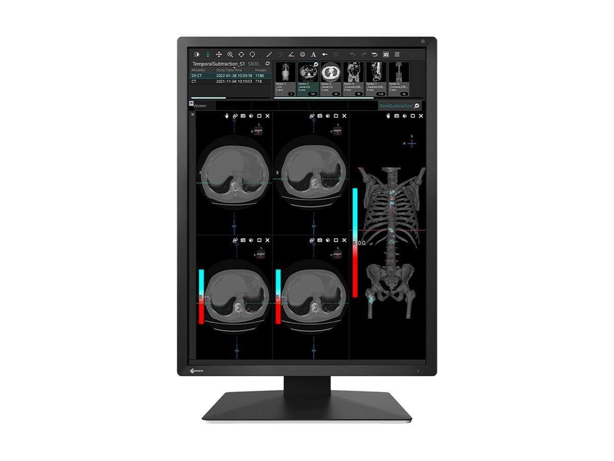Eizo MX217BK 21.3in LCD LED Color Monitor DICOM Black
