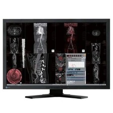 EIZO RadiForce MX241W 24-Inch WUXGA IPS Medical Monitor 1920x1200 Japan Import picture