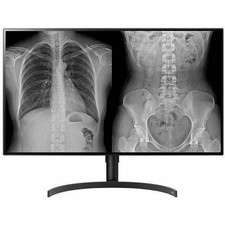 LG 32HL512D-B 32
