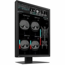 EIZO RadiForce MX217-BK 21