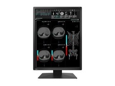 Eizo MX217BK 21.3in LCD LED Color Monitor DICOM Black picture